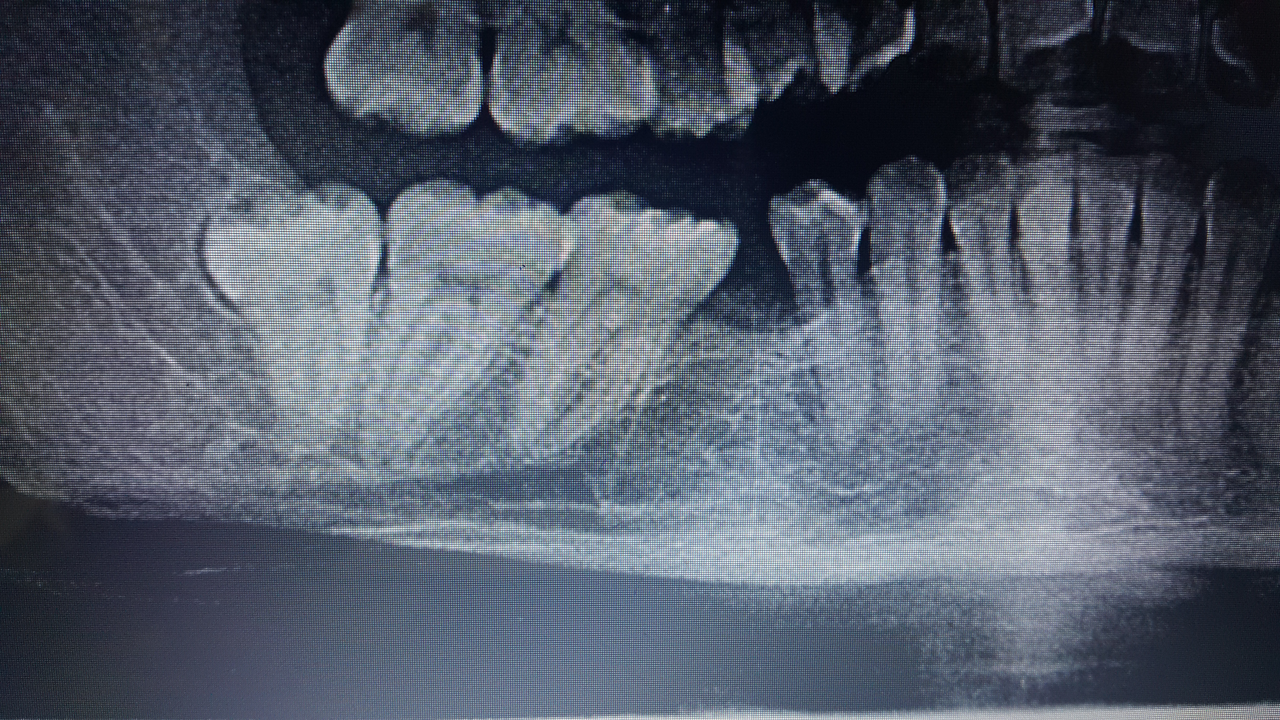 Toothache Due To IAN Injury