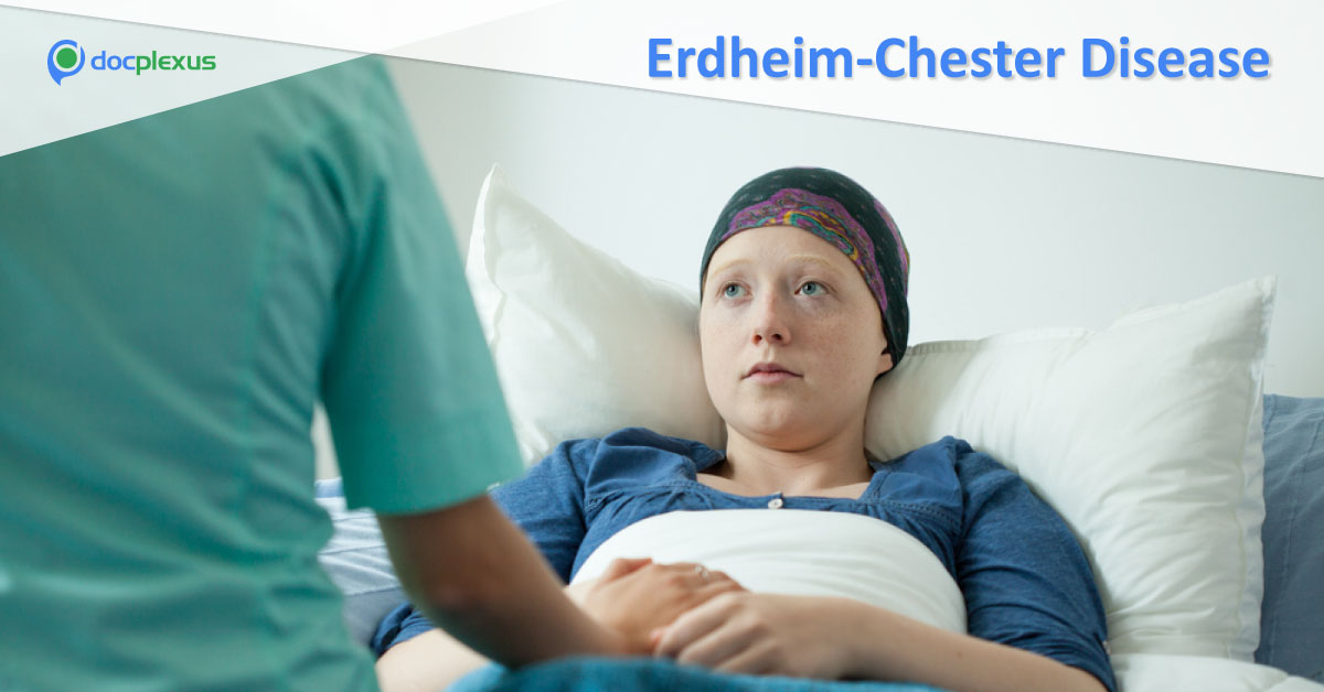 Vemurafenib Approved For Rare Blood Cancer