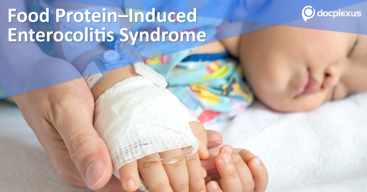 Differentials Of Food Protein–Induced Enterocolitis Syndrome