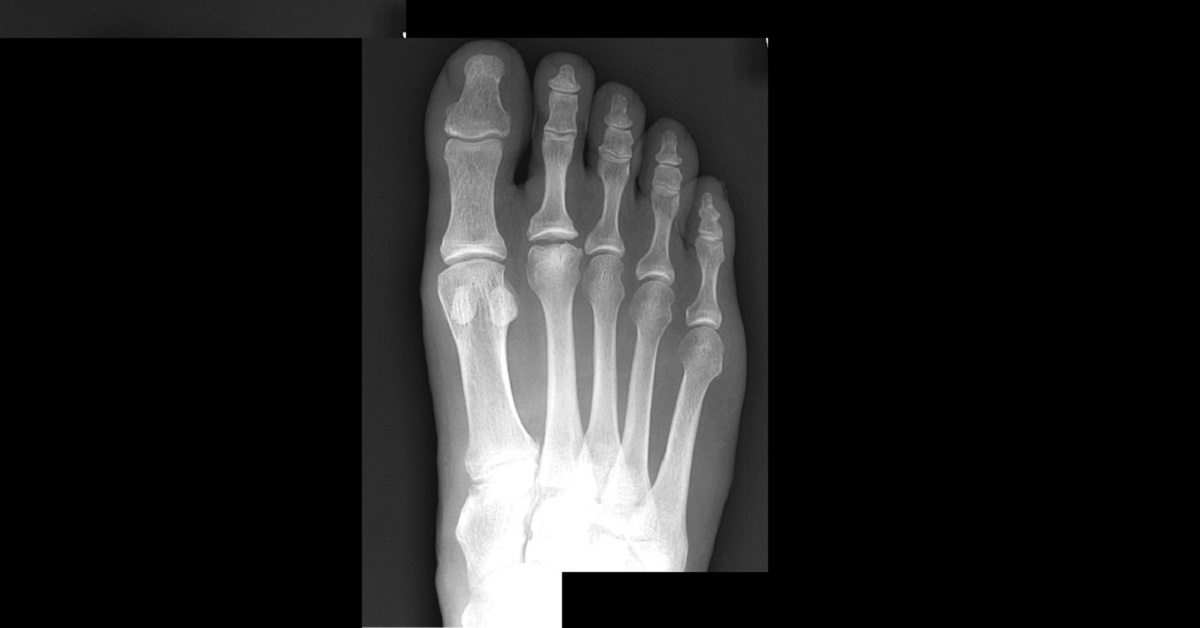 Diagnose This Condition