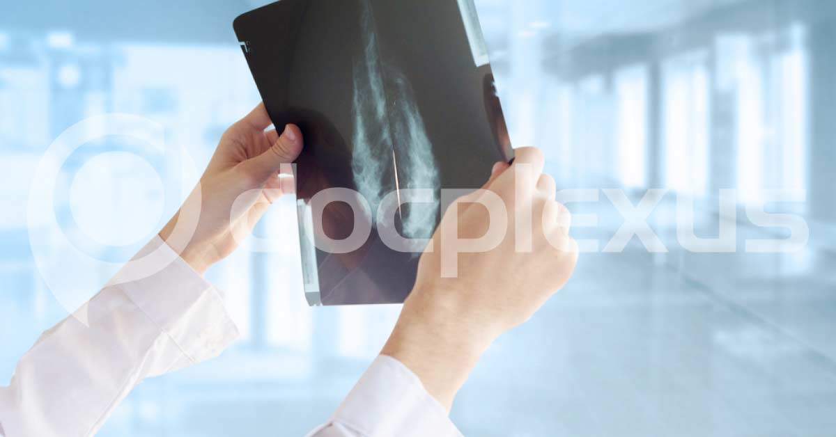 New Imaging Techniques For Breast Cancer