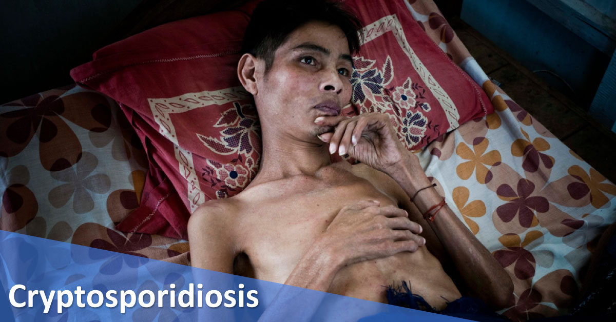 Cryptosporidiosis, Management In HIV Patients