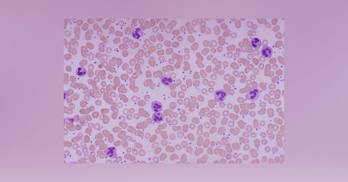 What does this pathological examination show?
