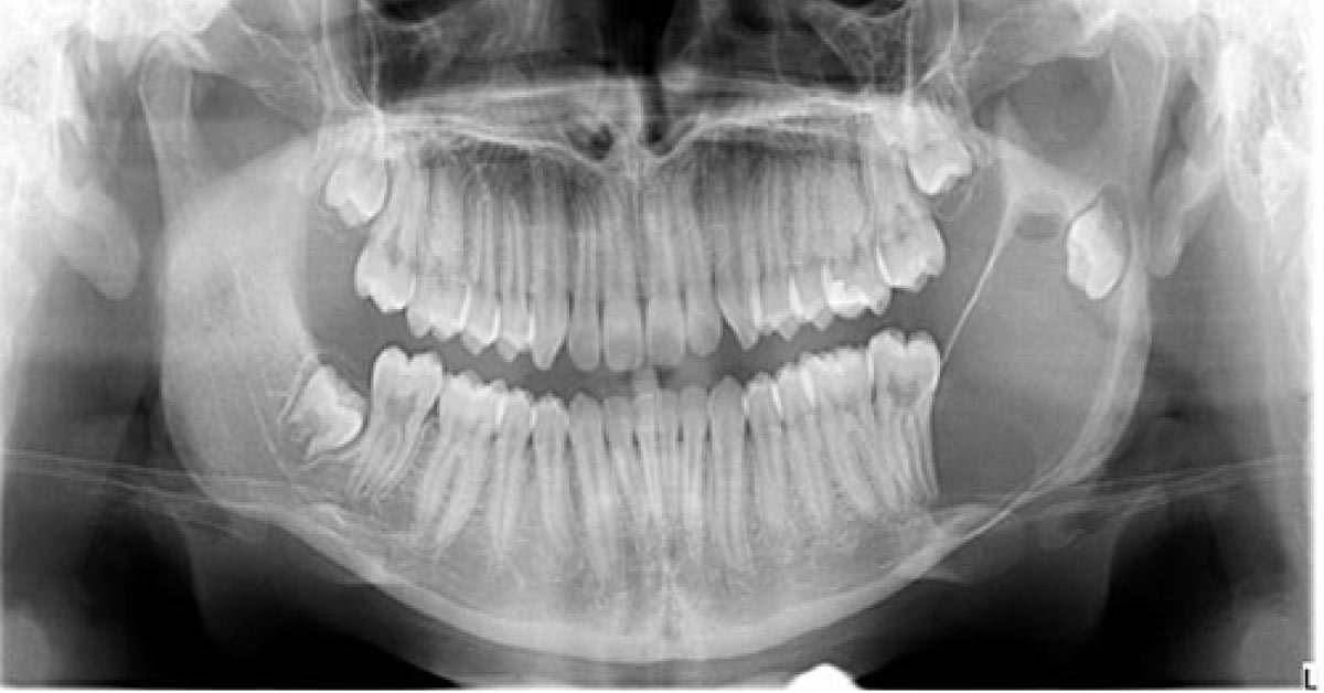 Identify This Condition In A Young Boy