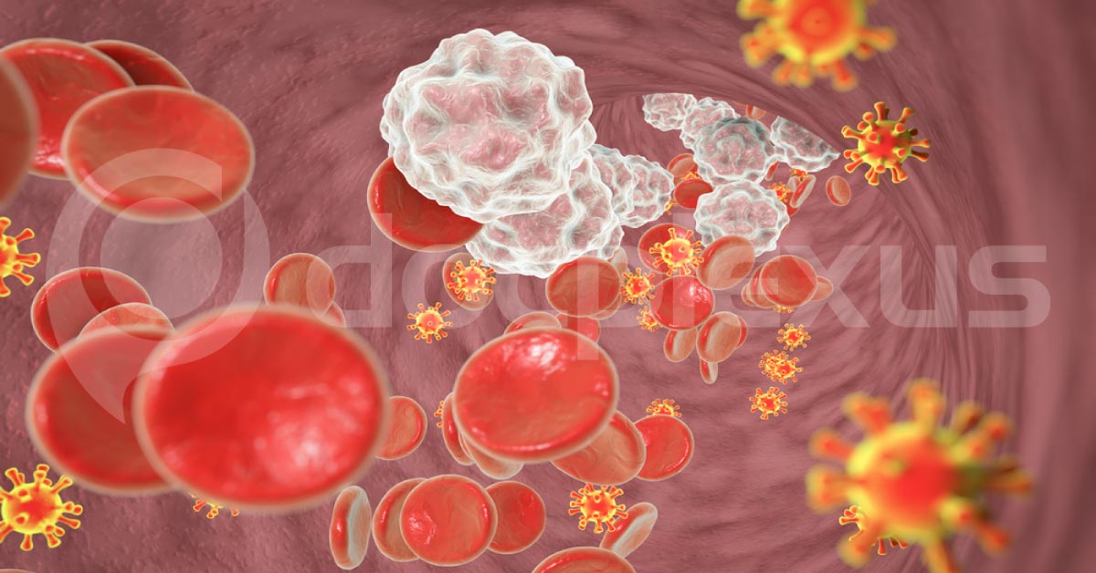 What Causes This Immunodeficiency?