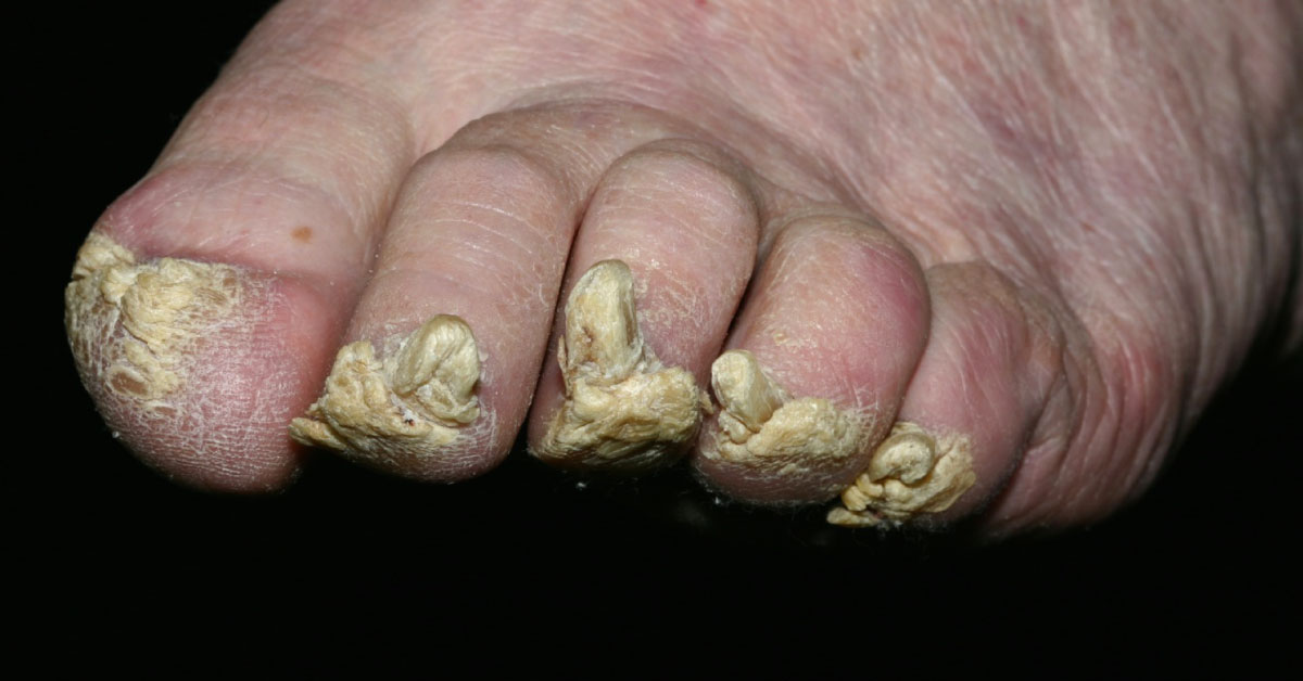 How Will You Manage This Dermatological Condition