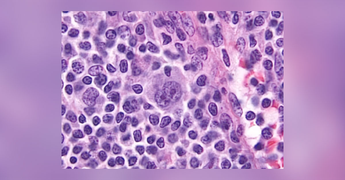 Identify Disorder From Slide