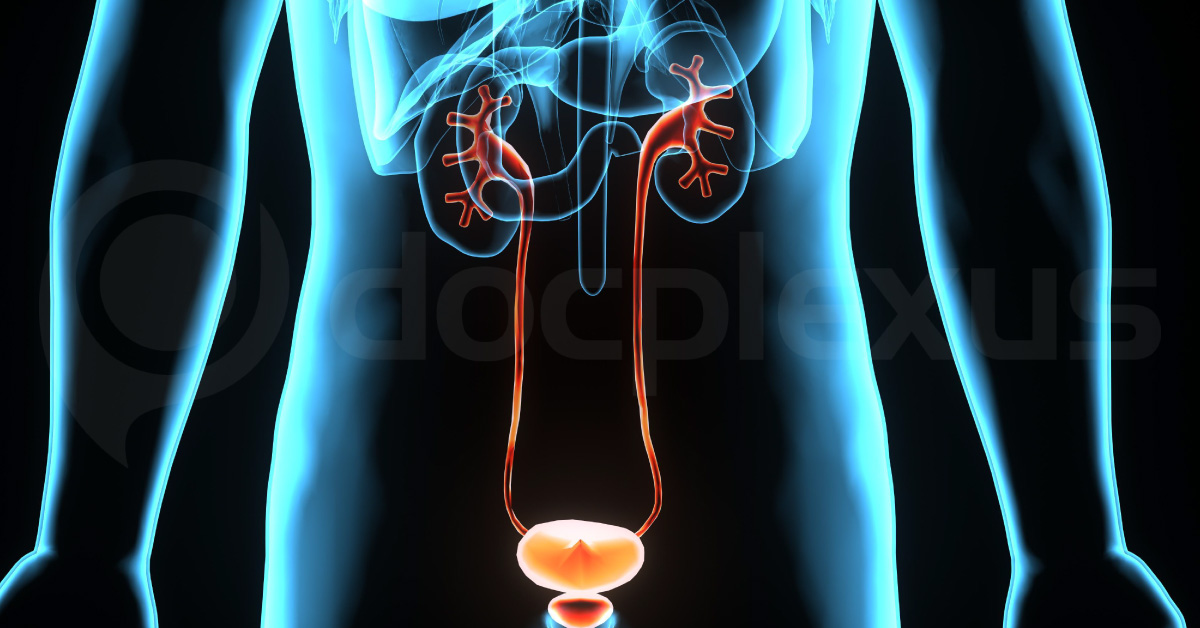 Urothelial Carcinomas Managenement of The Upper Urinary Tract