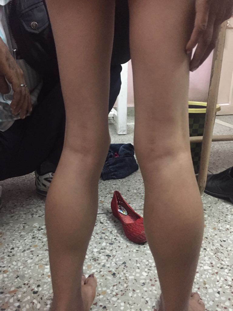 What Is This Disease? 