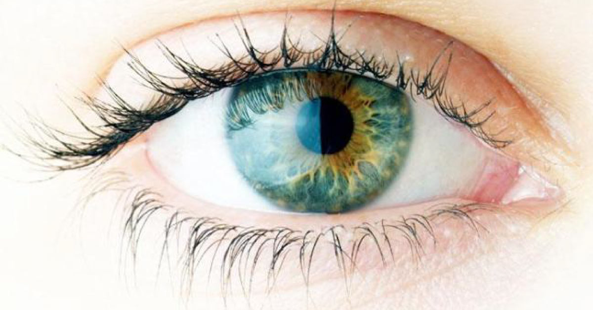 Corneal Transplant Can Be Used Upto 11 Days - A Study