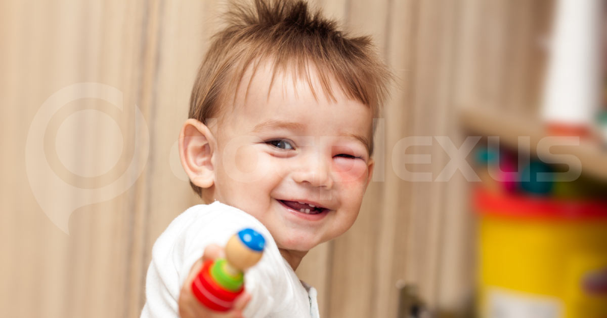 Abusive Head Trauma and The Eye In Infancy: Management Guidelines
