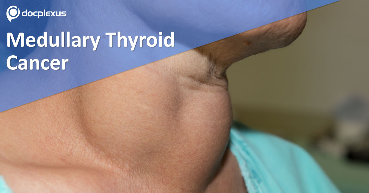 Medullary Thyroid Cancer: Management Recommendations