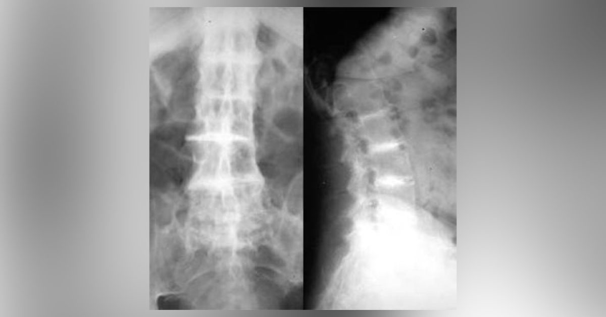 Pinpoint This Medical Condition
