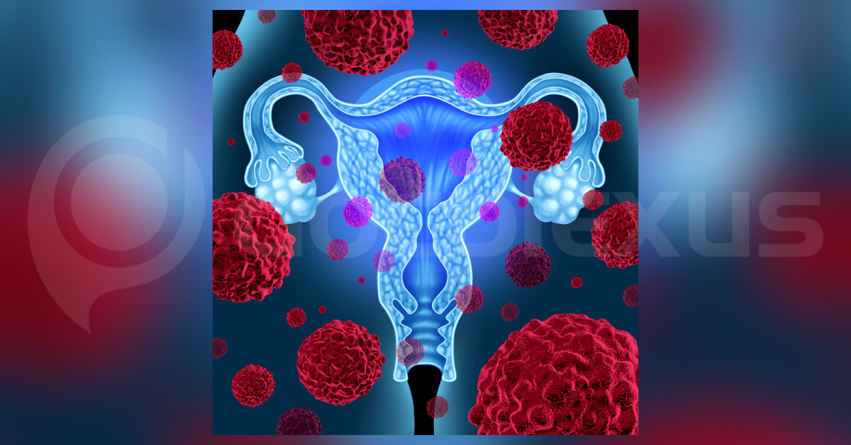 Women Using IUDs As Contraceptive Have Low Risk Of Cervical Cancer