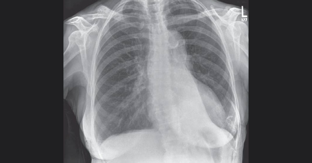 Interpret The Radiograph