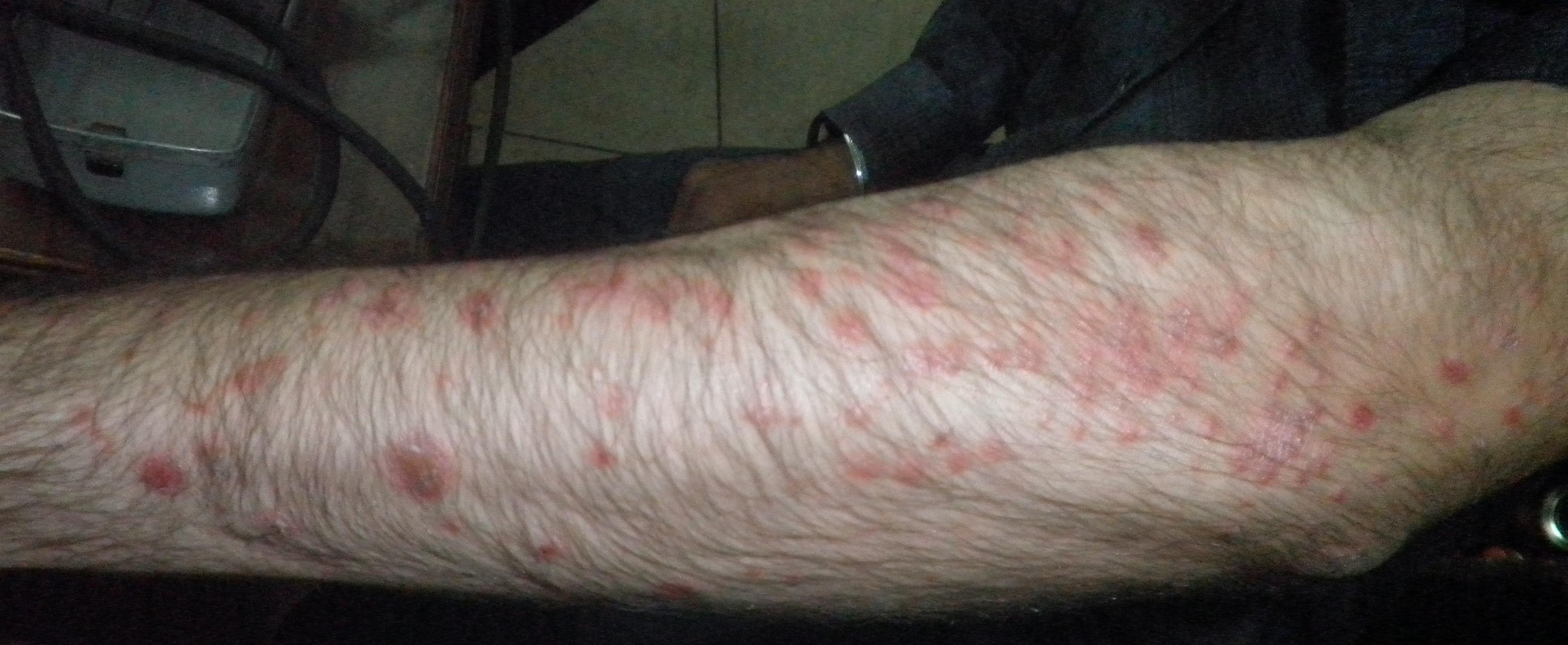 Diagnose This Dermatological Condition