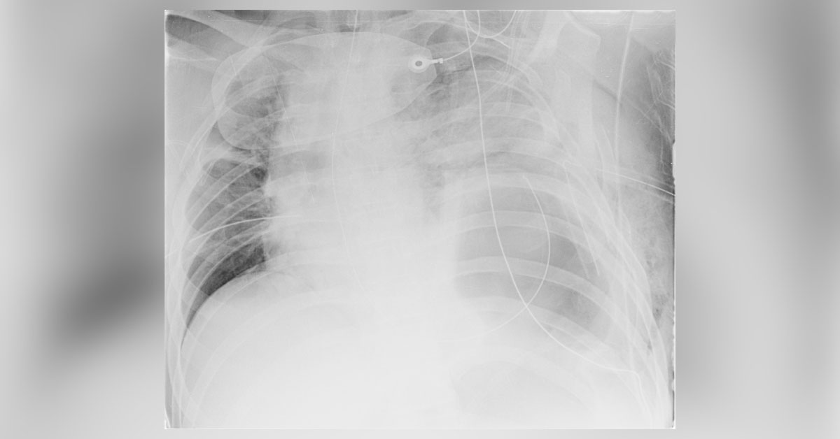 What Does This Radiograph Reveal?
