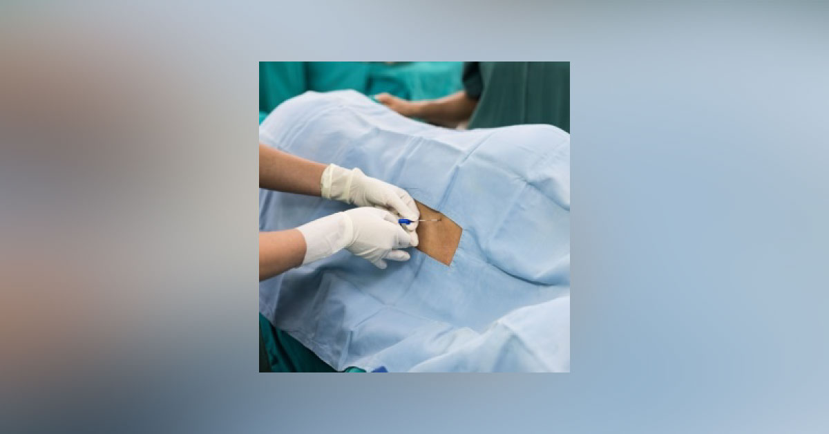 Choice Of Epidural Infusions In Epidural Anesthesia
