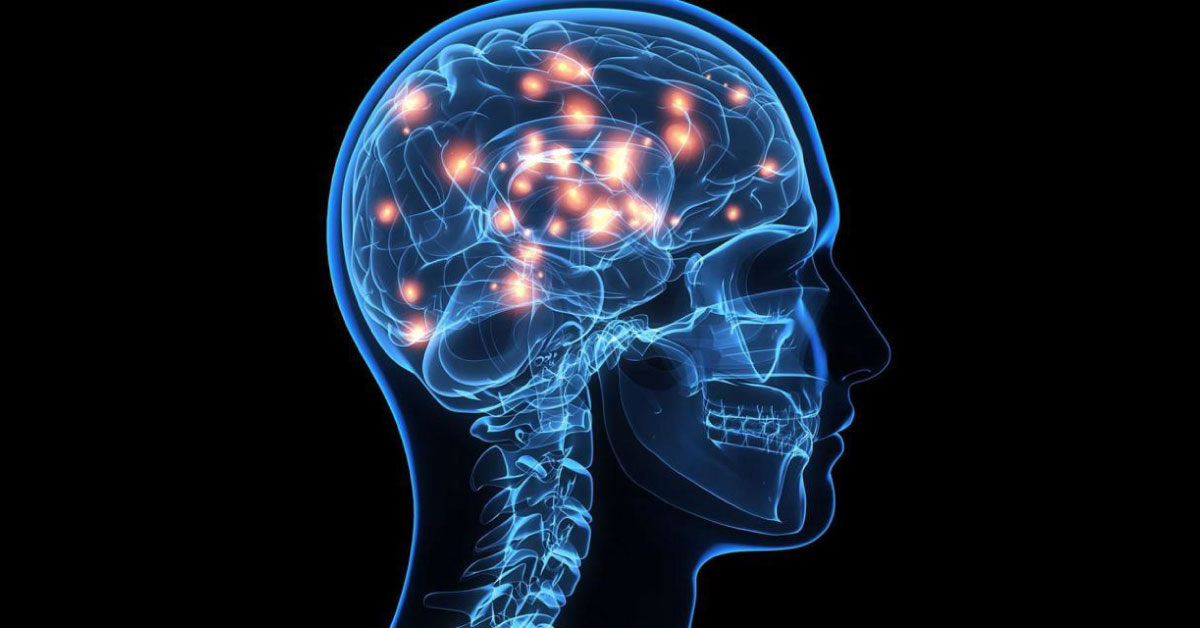 Migraine Can Be Treated Surgically By Decompressing Nerve Irritation Endoscopically