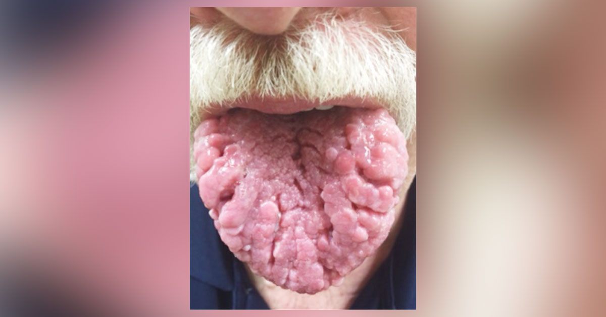 What Is This Condition?