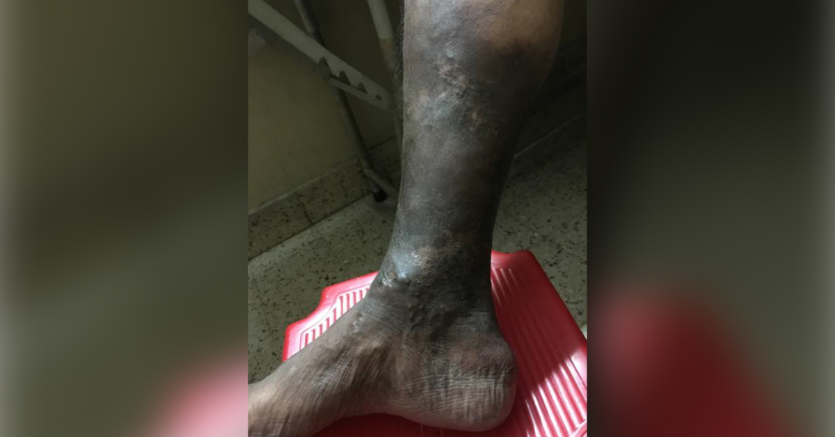 Identify This Condition