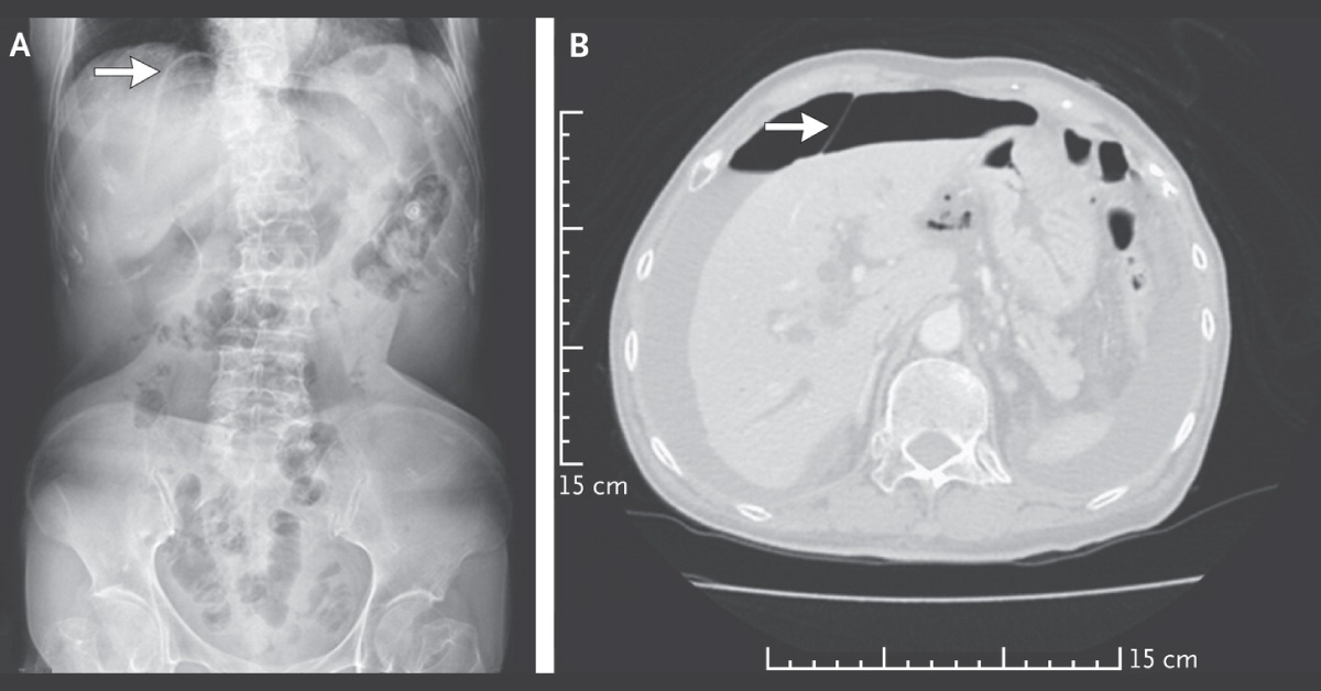 Identify This Condition In An Old Woman