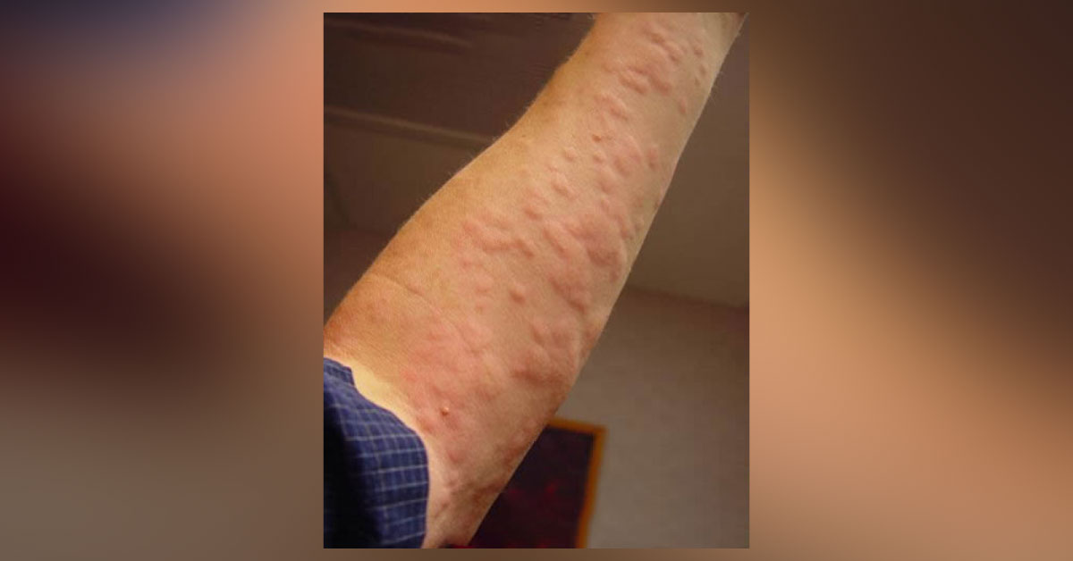 What Is Your Diagnosis?
