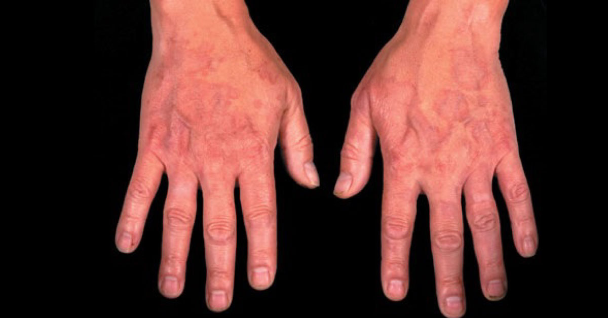 Diagnose Dermatology Spot