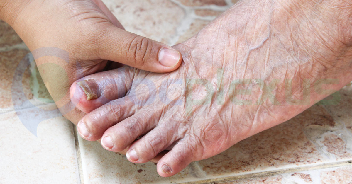 Common Foot Disorders In Geriatric Patients
