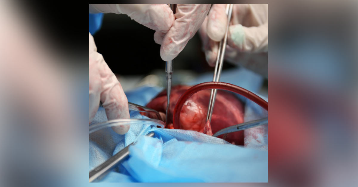 Acute Aortic Dissection: Management
