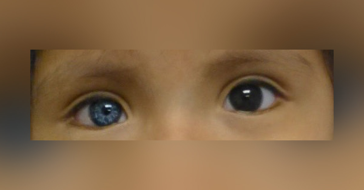 Blue-Brown Eyed Girl