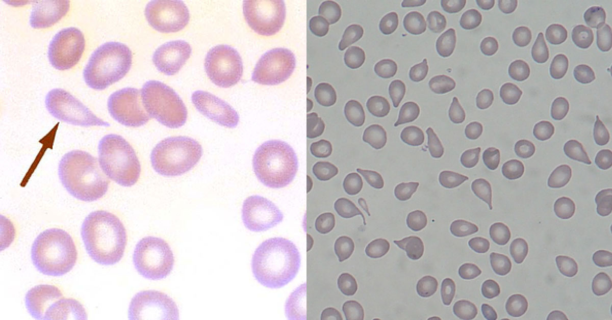 Identify The Underlying Condition