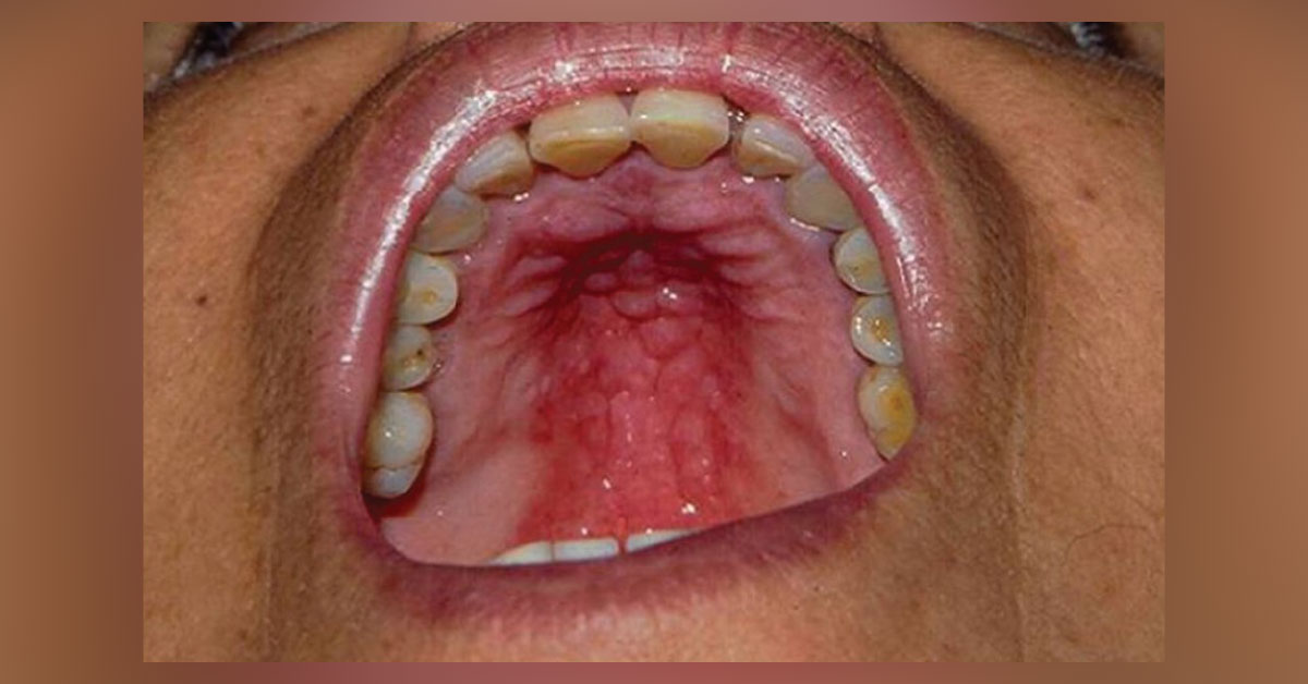 Identify the condition