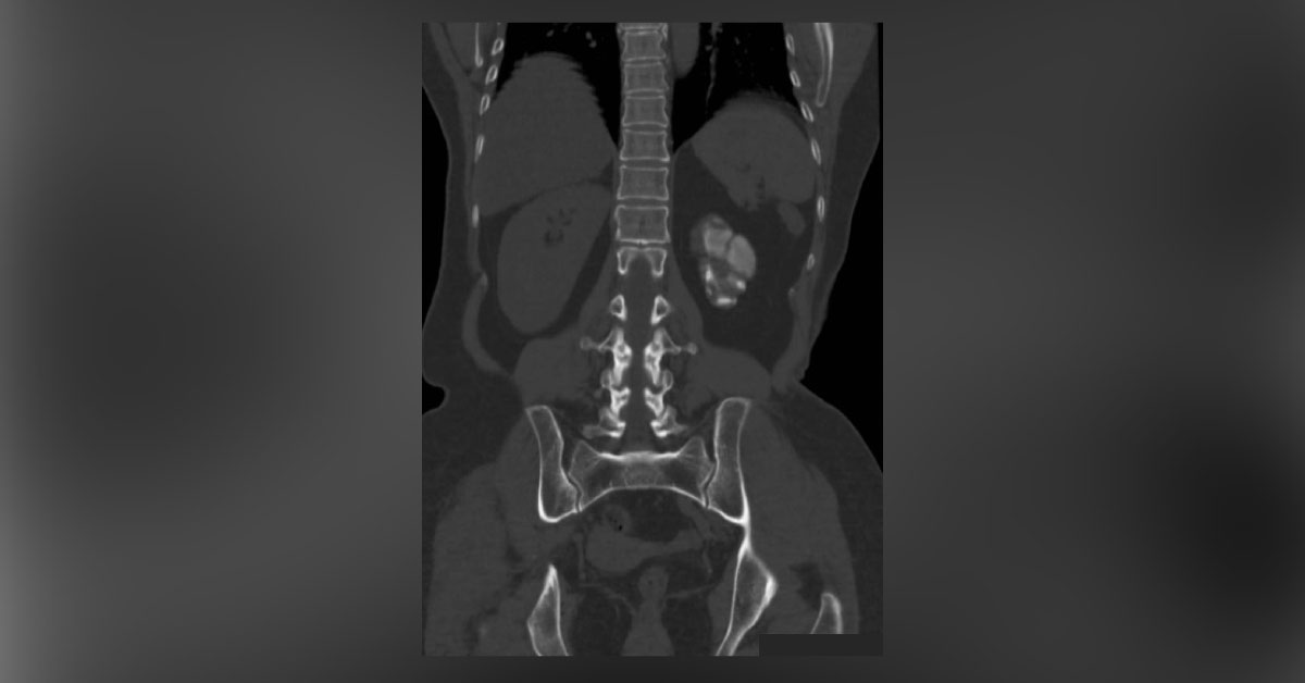 Interpret This Radiograph