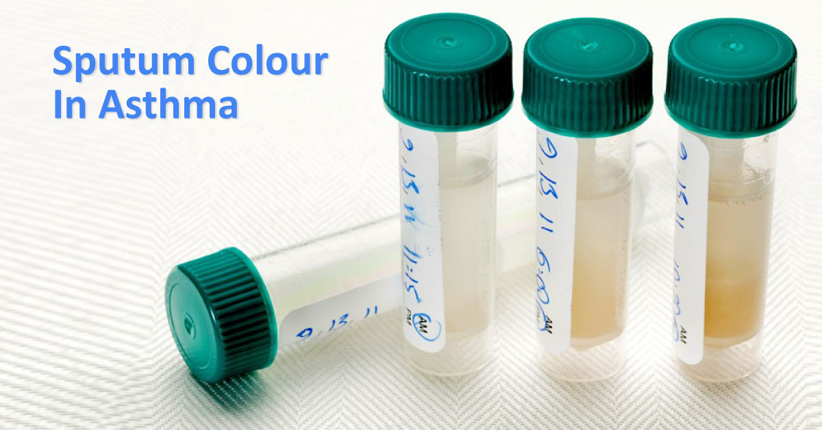 Sputum Colour Can Identify Neutrophilic Inflammation In Asthma