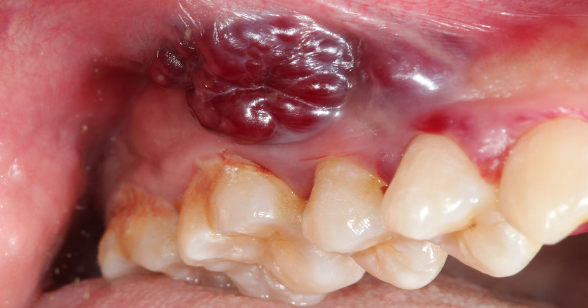 Diagnose This Oral And Dental Condition