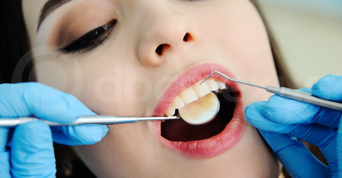 Which Bacterial Cells Generally Exist In Dental Plaque