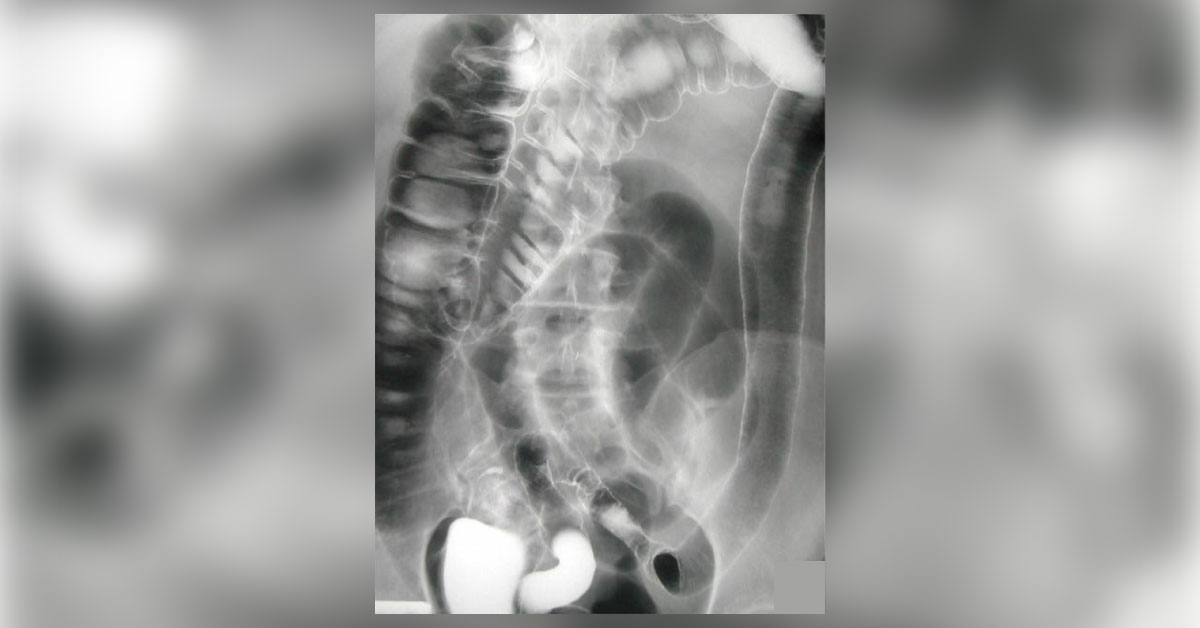 Diagnose The Condition