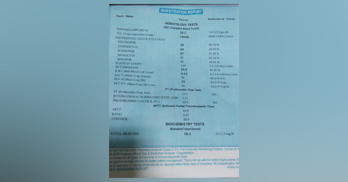 Mild Bleeding From Nose Of A Neonate 