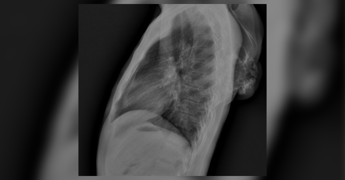 Spot The Underlying Condition