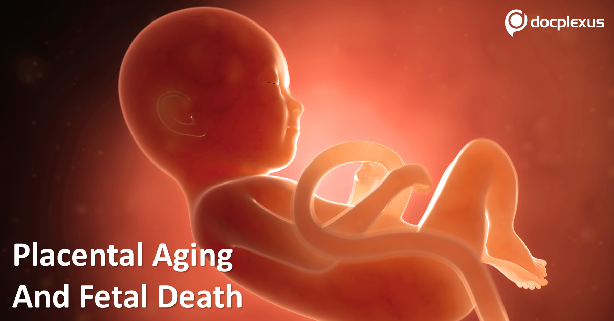 The Link Between Placental Aging And Fetal Death