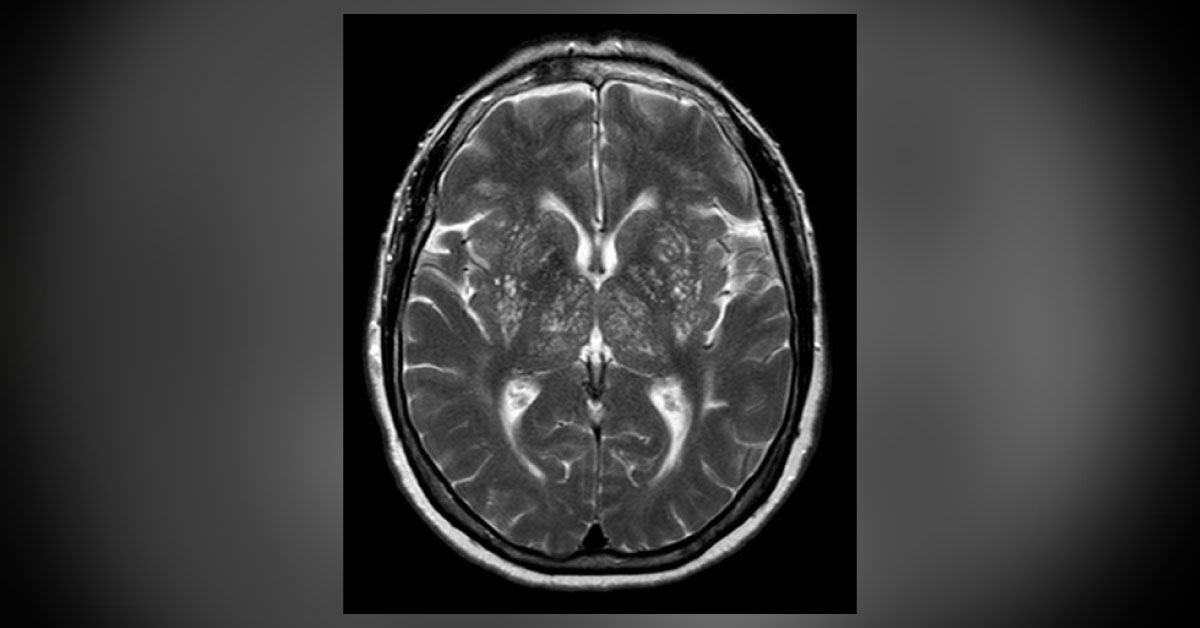 Interpret These Radiologic Findings