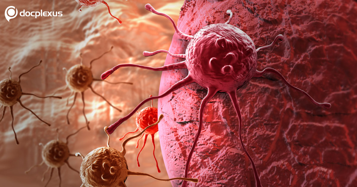 70 Yr Old Malarial Medicine May Help In Curing Cancer