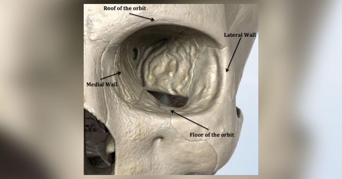 Medial Wall Of Orbit: Its Ophthalmic Importance