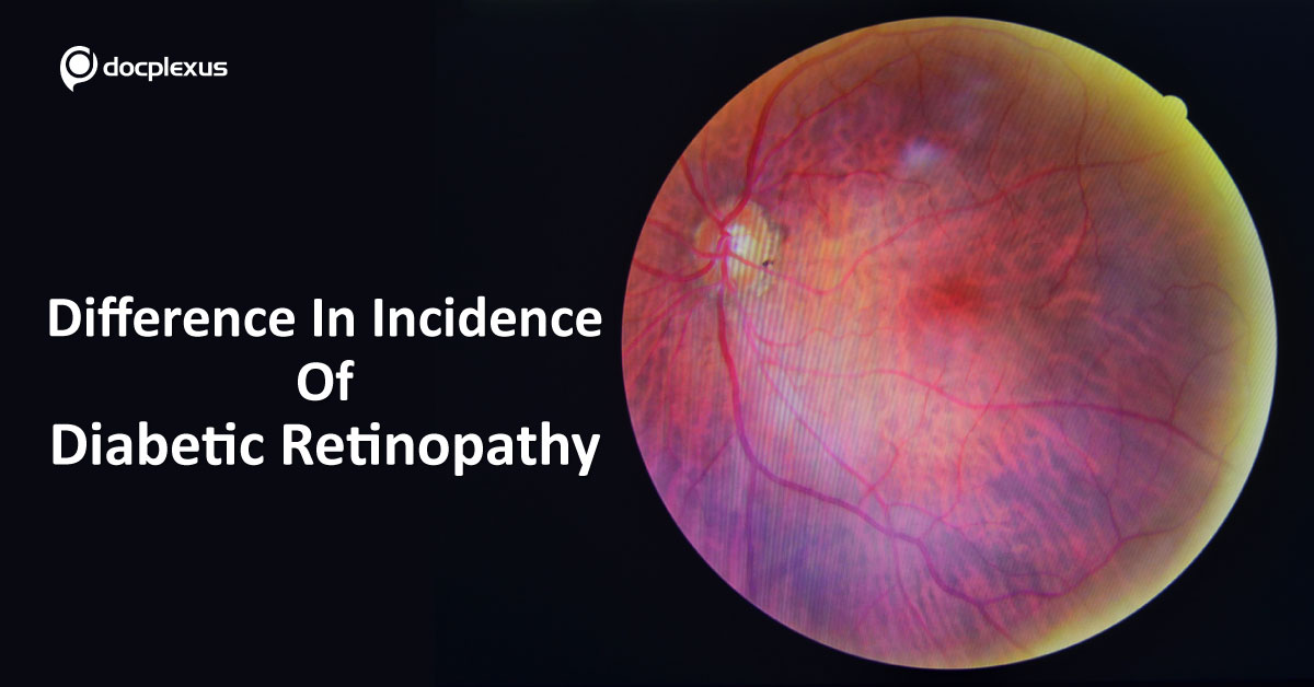Difference In The Incidence Of Diabetic Retinopathy Between Type I and II Diabetes