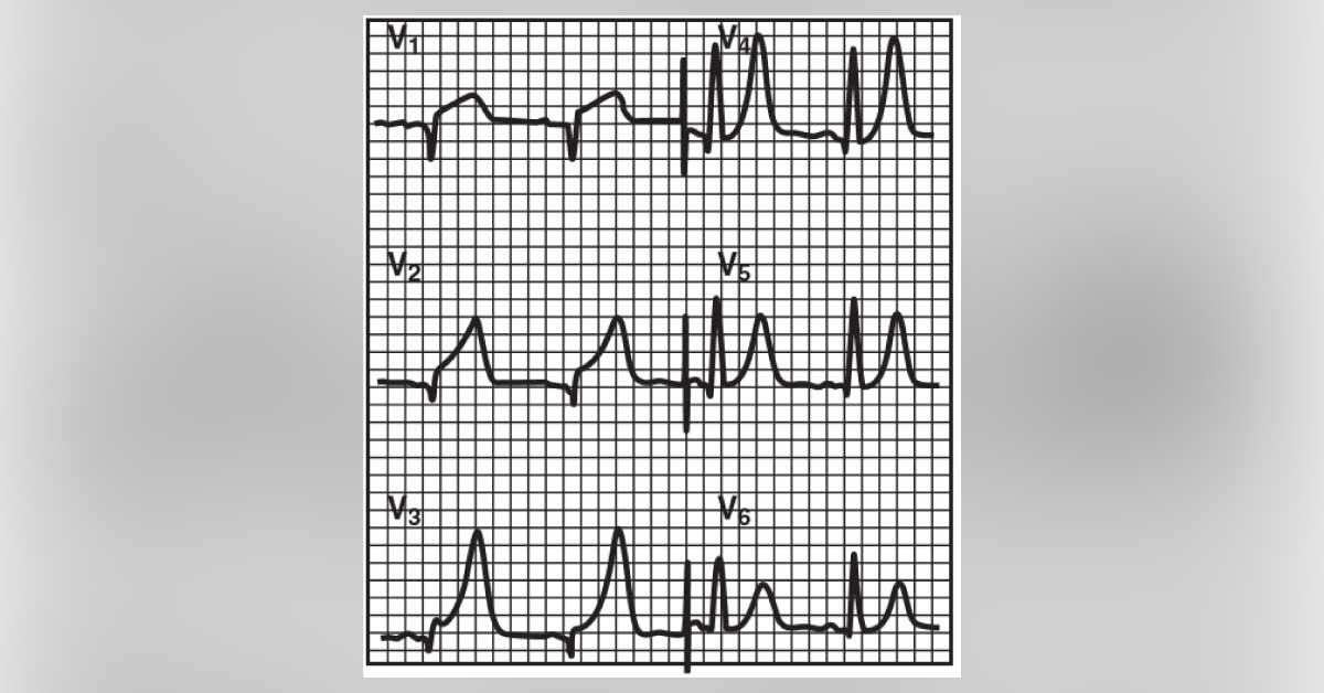 How To Manage This Sudden Chest Discomfort