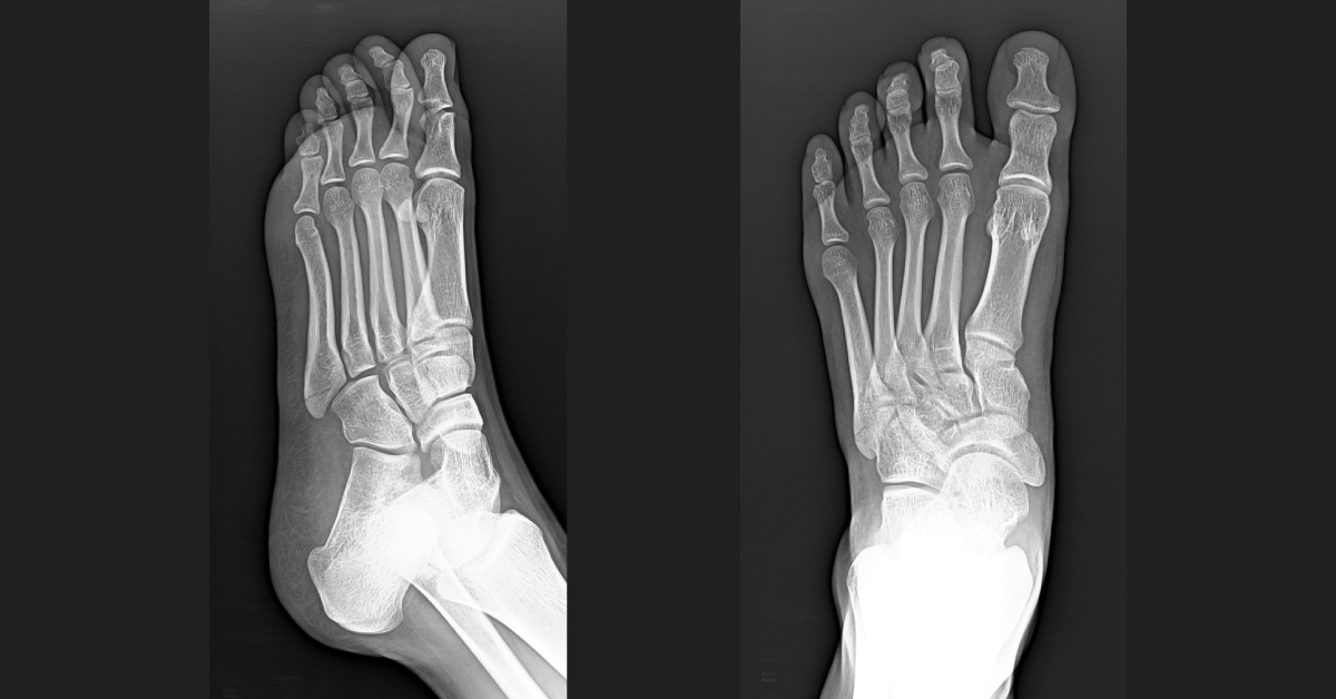 Identify the Abnormality