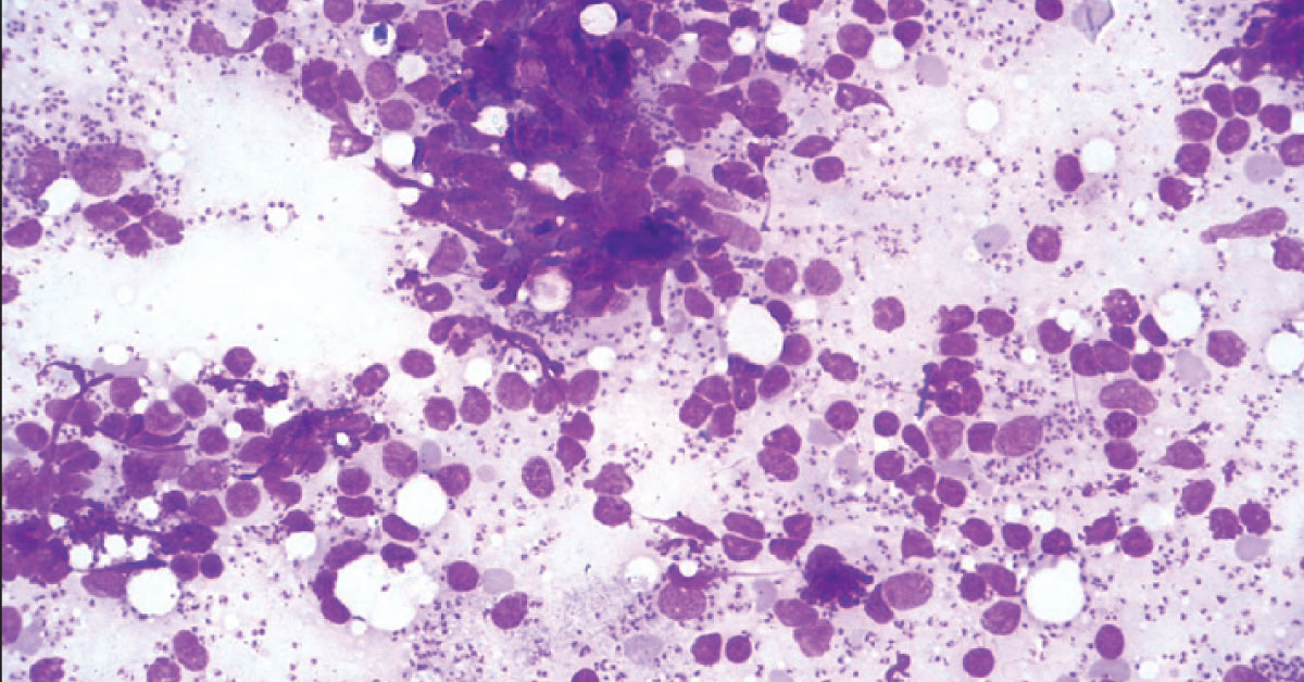Interpret The Pathological Findings