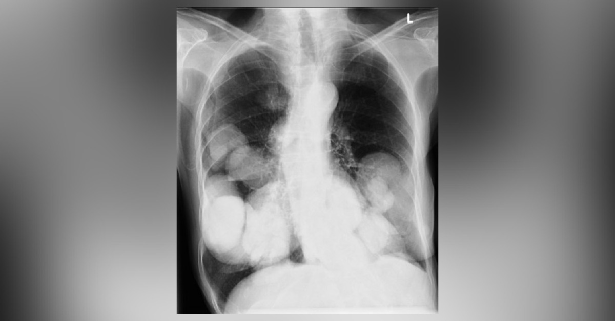 Identify These Radiologic Findings
