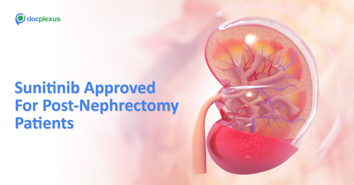FDA Approved Sunitinib Malate To Curb Kidney Cancer